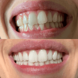 Gem Health & Beauty Gem Whitening Pen Crisp Mint (Whitens Enamel) 4ml